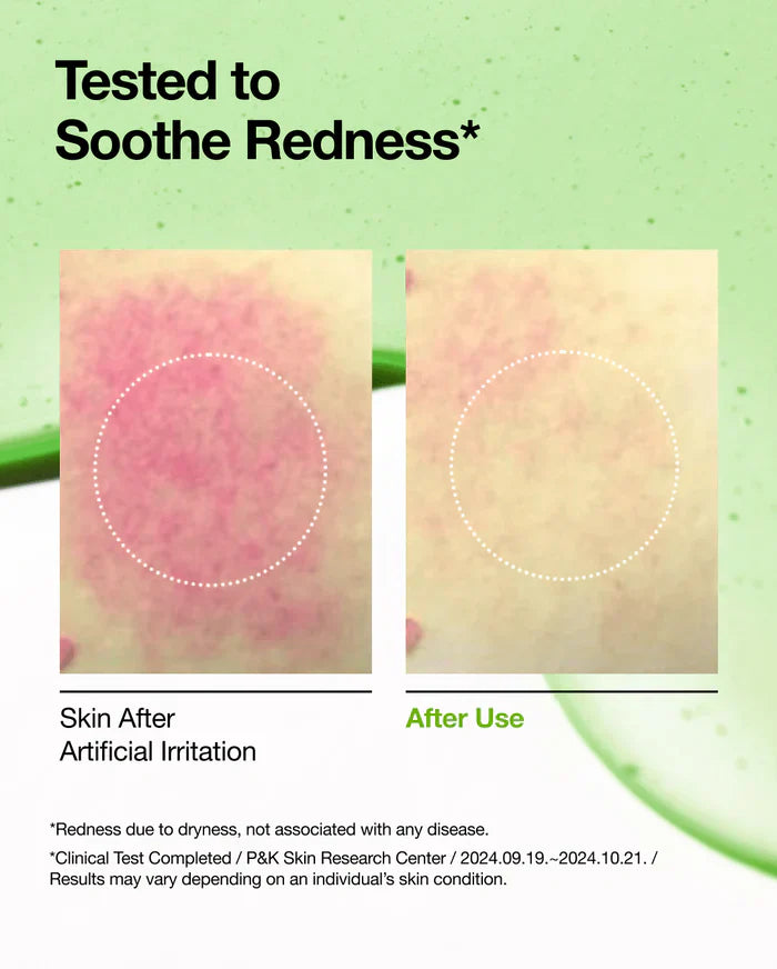 Anua Azelaic Acid 10% Redness Serum – 30ml