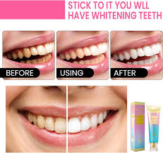 BodyAccel Niacinamide Whitening Toothpaste